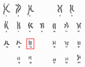Cromosoma 15, Síndrome de Angelman, Apadrina un Ángel